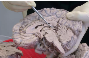 Neuroanatomy for Neuropsychologists